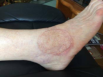 christine raymond bowen technique practitioner 001