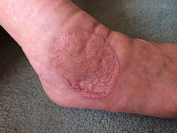 christine raymond bowen technique practitioner 002