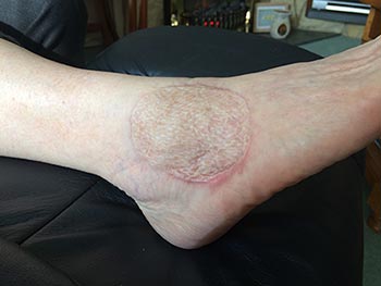 christine raymond bowen technique practitioner 003